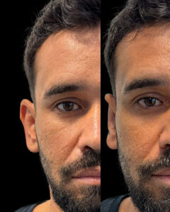 54ED5A91-BCFF-4647-B6F3-4F77E7A31C9B