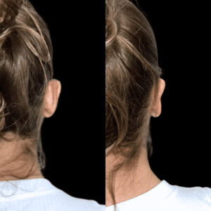 Design sem nome.zip - 1(1)